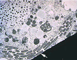 cross section of Legionella chains